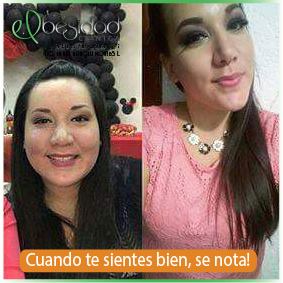 Resultados Obesidad Clínica 04