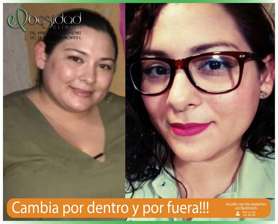 Resultados Obesidad Clínica 05
