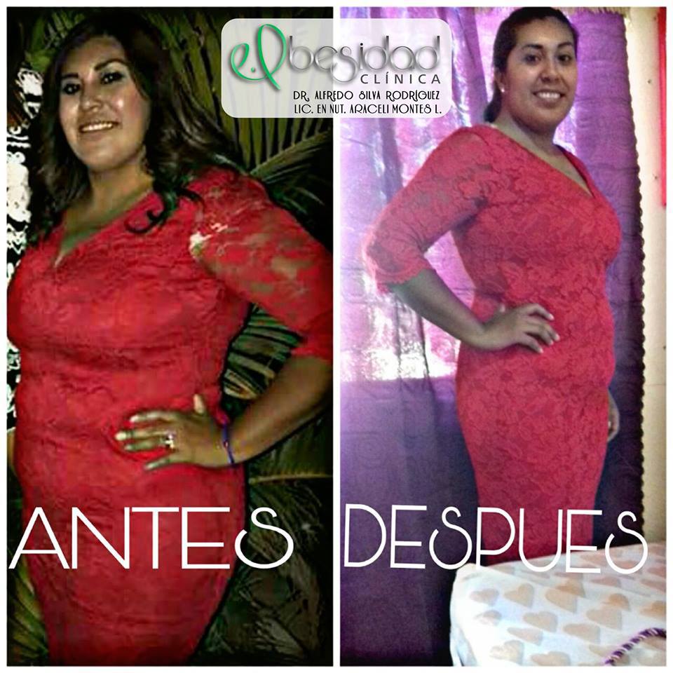 Resultados Obesidad Clínica 06
